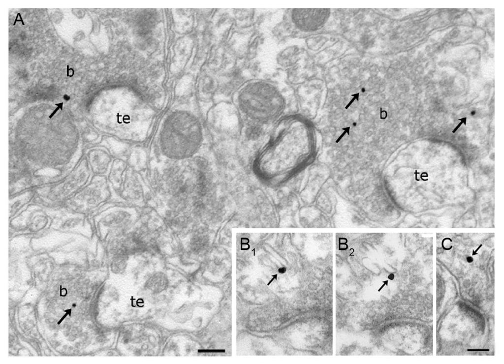 ihc_2